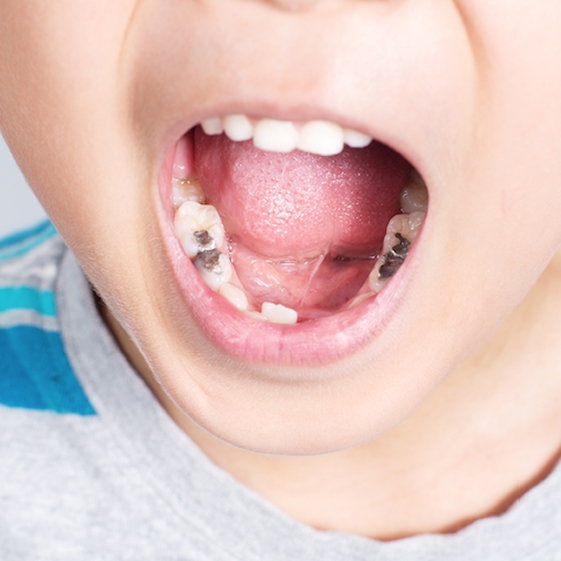 Dentist teaching a child about dental care