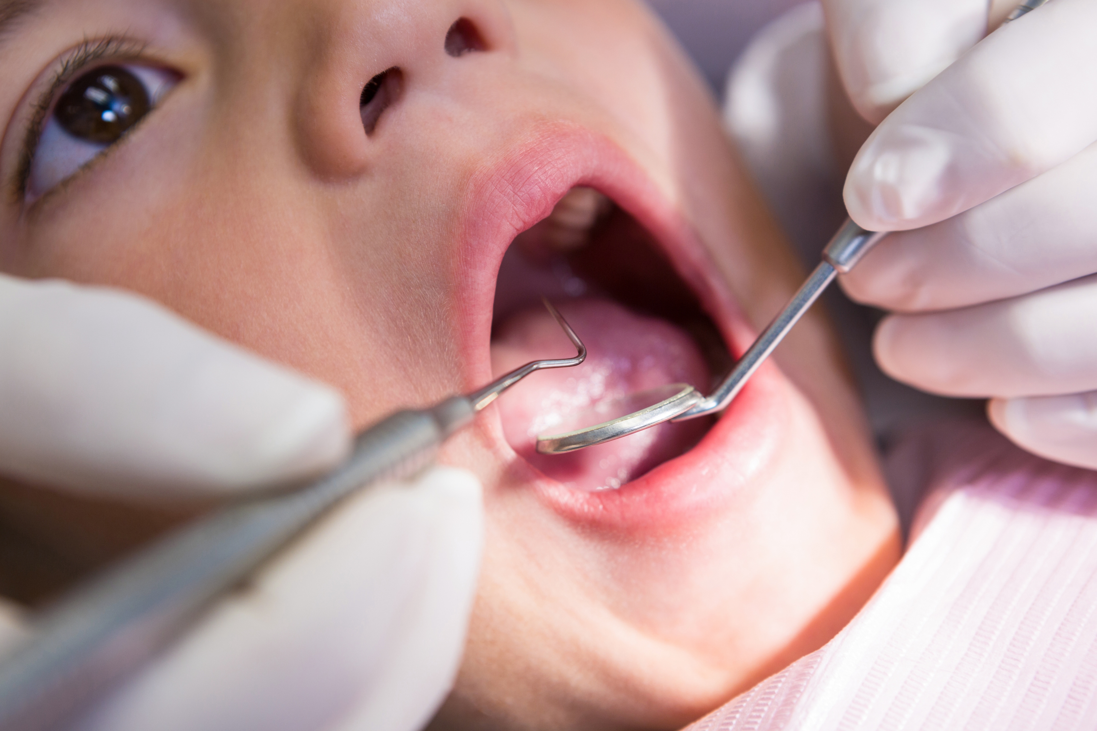 Frenectomy