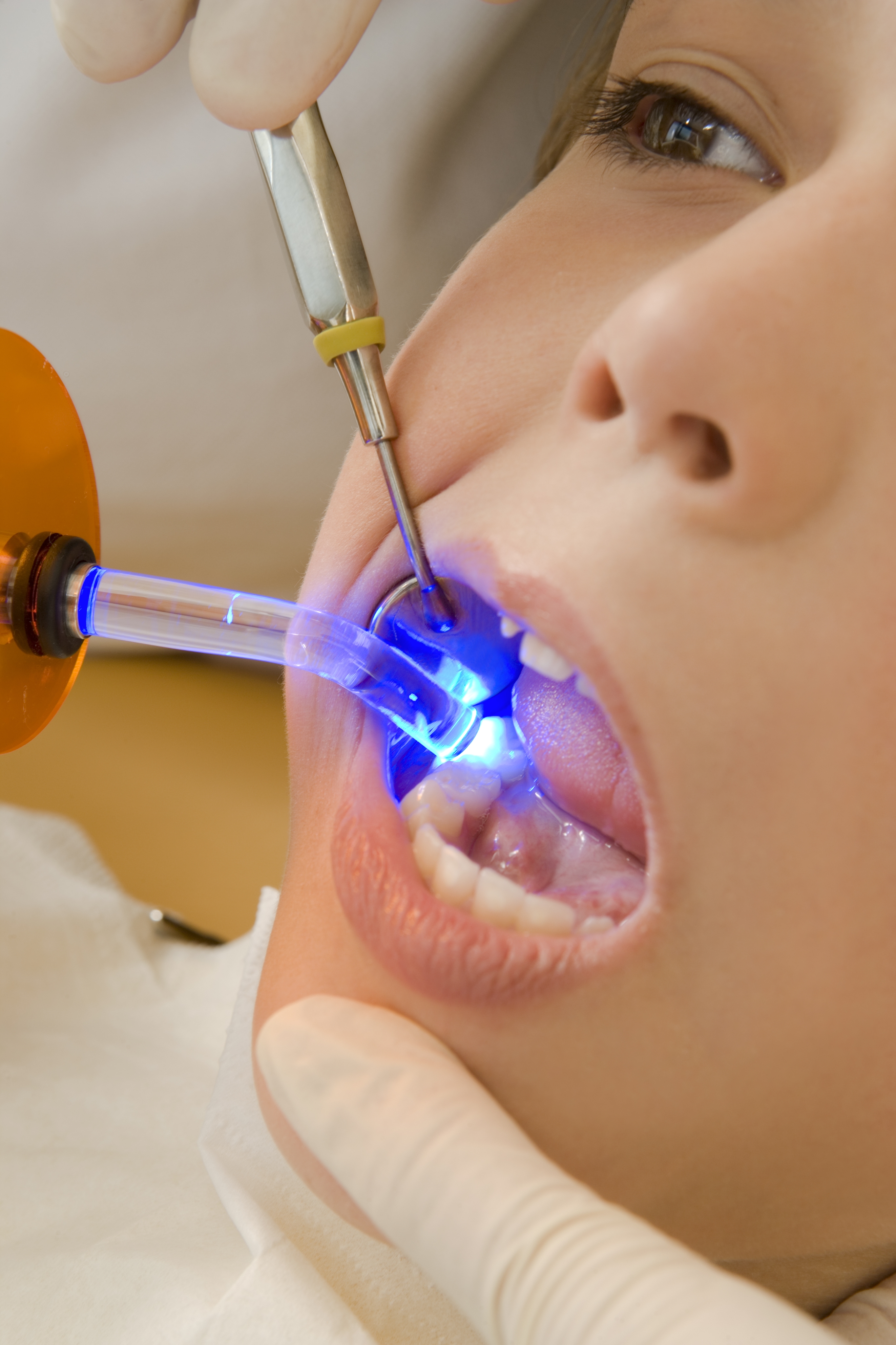 Laser Dentistry