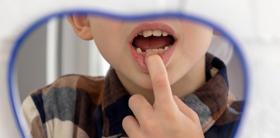 What Does a Fluoride Treatment Cost?