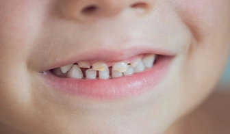 Pediatric dentist checking a toddler's new teeth